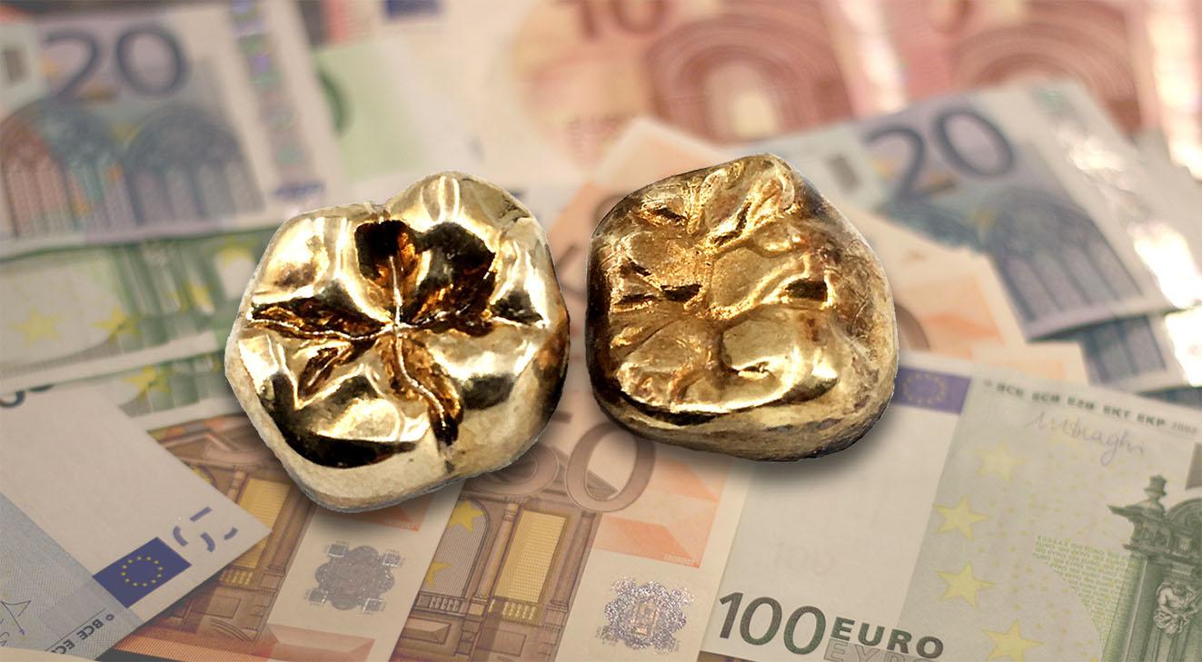 Lohnt sich der Verkauf von Zahngold?